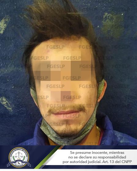 FGE detuvo a zacatecano por lesiones y daños en las cosas