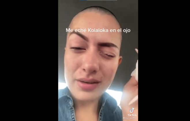 Auch Esta Influencer Confundi Gotas Para Los Ojos Con Kola Loka Peri Dico Region Centro