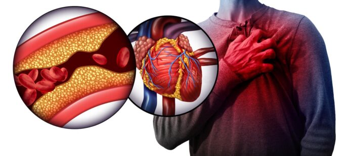 enfermedad cardiaca