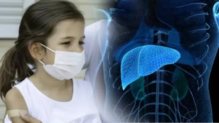 hepatitis
