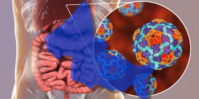 Incremento de contagios de Hepatitis A en San Luis Potosí