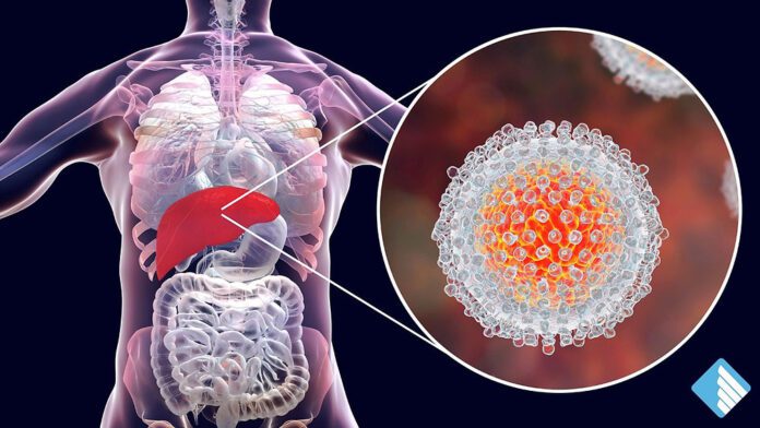 SLP reporta 70 casos de hepatitis C
